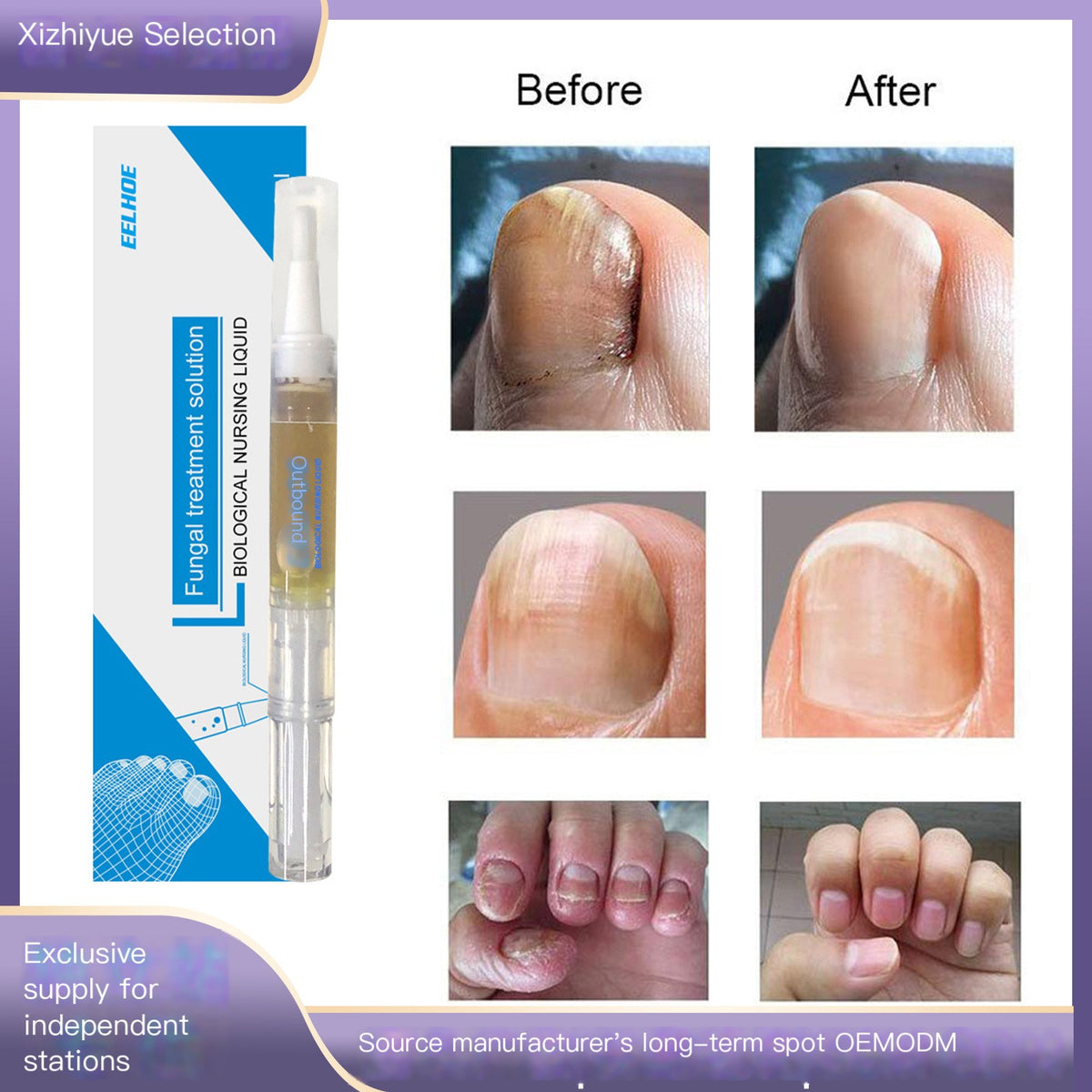 EELHOE Gray Nail Treatment and Repair Liquid