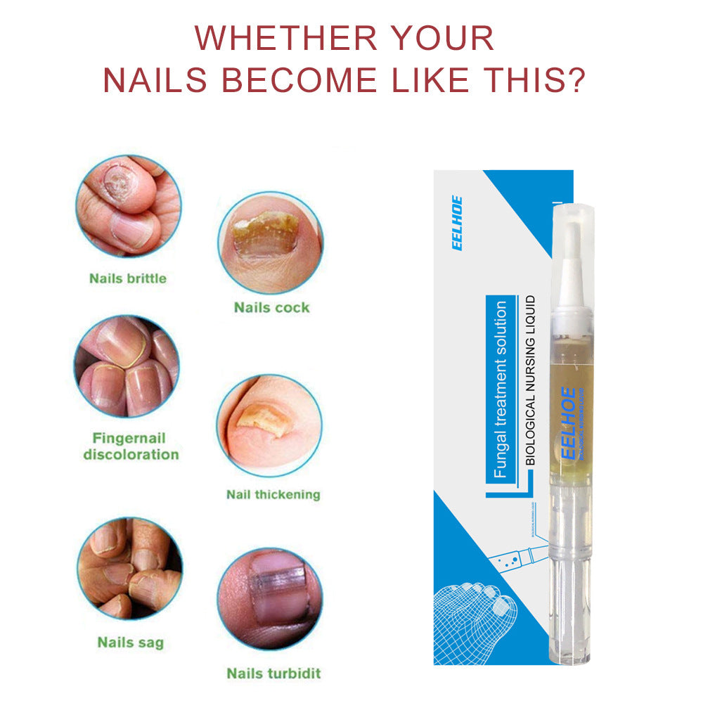 EELHOE Gray Nail Treatment and Repair Liquid